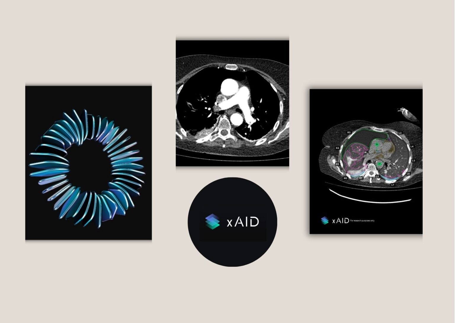 Expert Guide to Implementing AI for Radiology Workflows